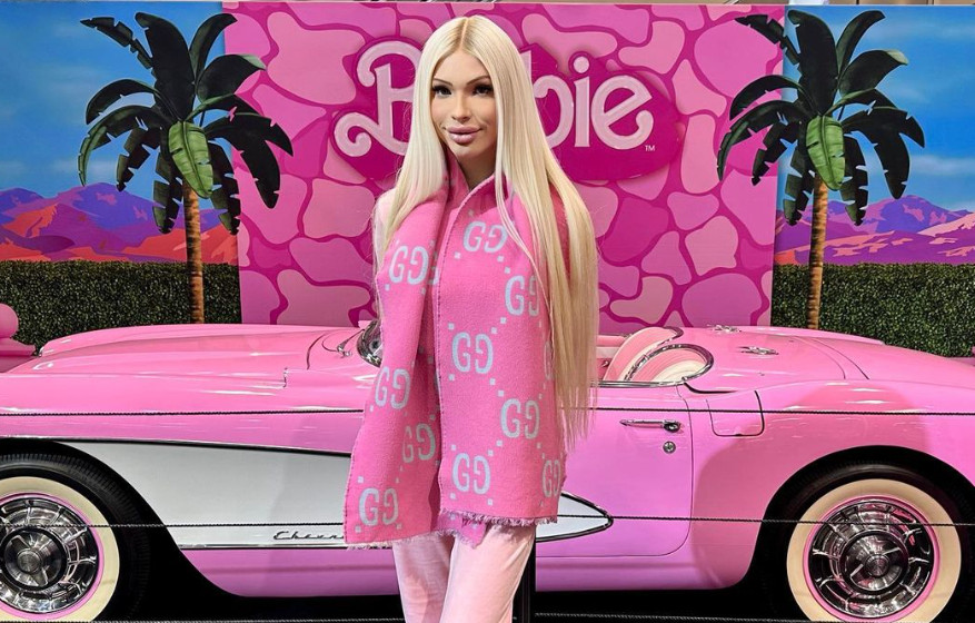 Ξόδεψε 50.000$ για να μεταμορφωθεί σε Barbie – Τώρα το μετανιώνει και θέλει να γίνει ξανά φυσική