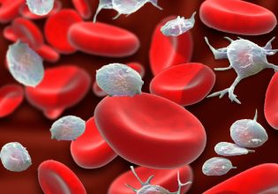 Συνθετικά αιμοπετάλια υπόσχονται να σταματήσουν σοβαρές αιμορραγίες