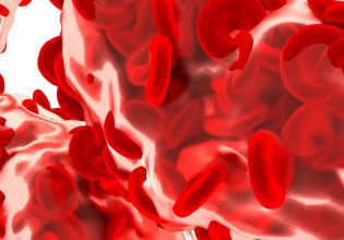 Καλύτερη ποιότητα ζωής στην αιμορροφιλία με νέες θεραπείες