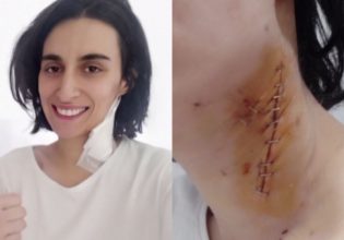 «Με μαχαίρωσε στο λαιμό και προσπάθησε να με στραγγαλίσει» – Σοκάρει θύμα ενδοοικογενειακής βίας