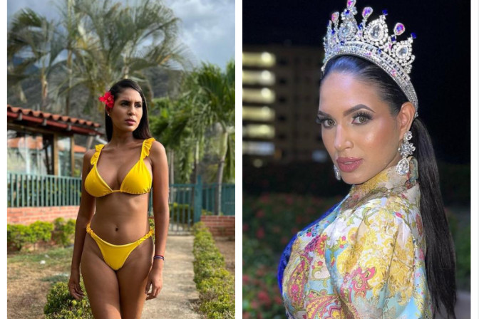 Η επέμβαση που οδήγησε στον θάνατο 24χρονη βασίλισσα ομορφιάς