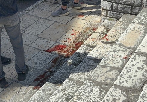 Κέρκυρα: Μαθητής μαχαίρωσε εφήβους - Στο νοσοκομείο οι τραυματίες