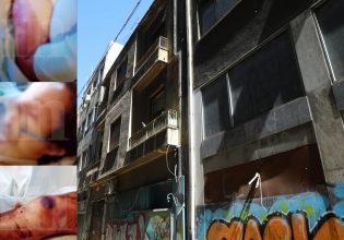 Ομόνοια: Φωτογραφίες ντοκουμέντο από το βασανιστήριο της 33χρονης