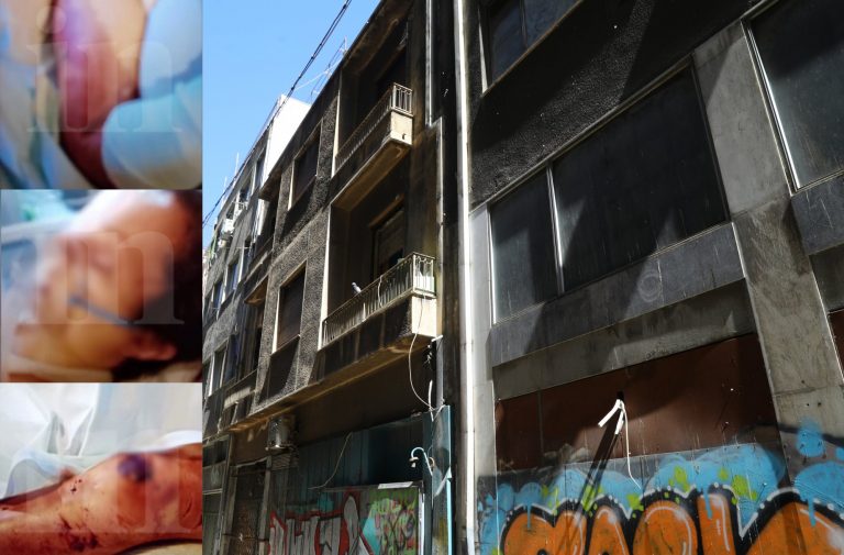 Ομόνοια: Φωτογραφίες ντοκουμέντο από το βασανιστήριο της 33χρονης