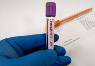 Παρβοϊός Β19: Tα συμπτώματα, η μετάδοση και τα μέτρα πρόληψης