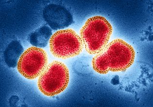 Γρίπη: Πειραματικό φάρμακο υπόσχεται πρόληψη της γρίπης