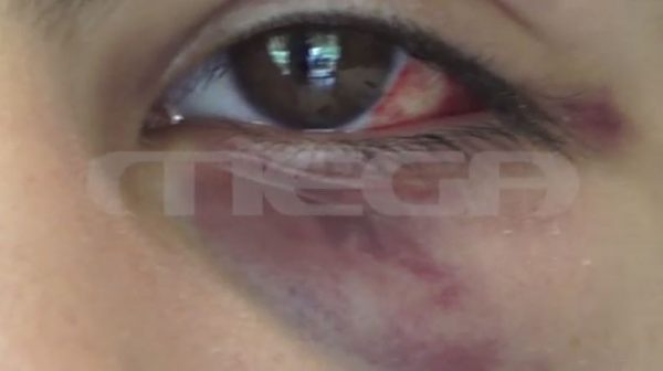 Άγιος Δημήτριος: Ομάδα ανηλίκων ξυλοκόπησε 15χρονο για ένα τραγούδι στο TikTok – Τι λέει το θύμα