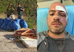 Πάρνηθα: Άγρια επίθεση σε εθελοντική ομάδα – Στο νοσοκομείο με τρεις μαχαιριές ένας άνδρας