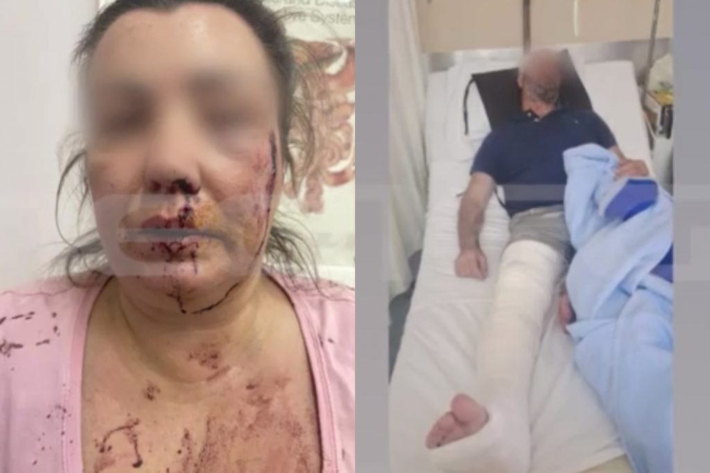 Αιγάλεω: Ζευγάρι έπεσε θύμα άγριου ξυλοδαρμού μέρα μεσημέρι στην Πέτρου Ράλλη – «Ήθελαν να μας σκοτώσουν»