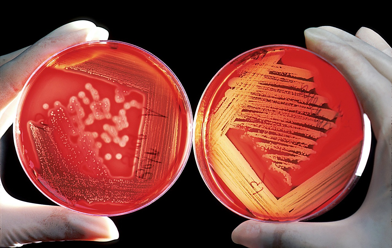 Αντιβιοτικά: Η πανδημία «θα μοιάζει ασήμαντη» μπροστά στις συνέπειες των ανθεκτικών μικροβίων