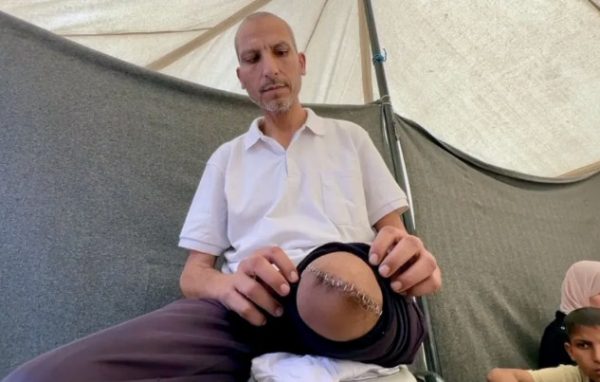 Ισραηλινά νοσοκομεία μετατρέπονται σε κολαστήρια – Αναισθησία με το σταγονόμετρο σε χειρούργηση Παλαιστινίων