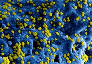 Έρευνα: Η μικροβιακή αντοχή προκαλεί 750.000 θανάτους ετησίως που θα μπορούσαν να αποτραπούν