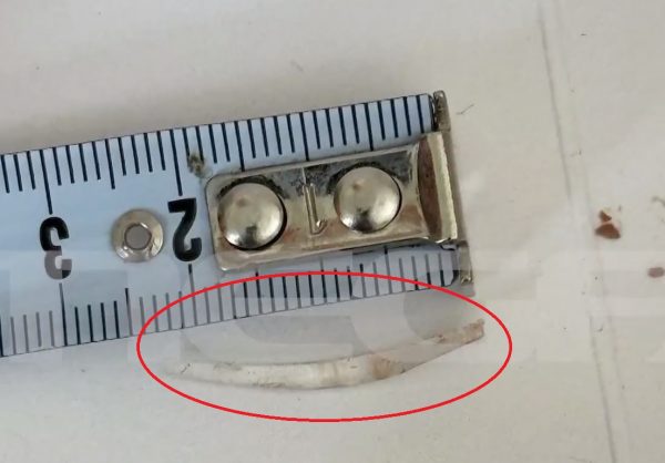 Παραλίγο να καταπιεί σπασμένο γυαλί που βρήκε μέσα σε γλυκό από ζαχαροπλαστείο