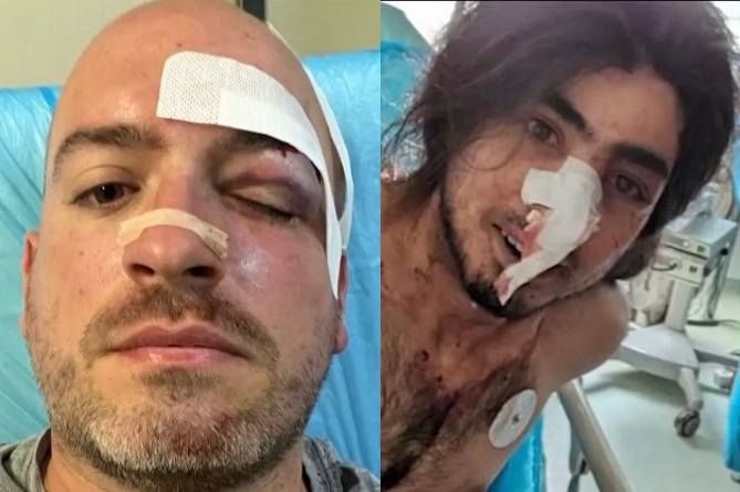 Συγκλονίζουν οι μαρτυρίες των εθελοντών στην Πάρνηθα: «Μας επιτέθηκαν σαν αγέλη άγριων ζώων»