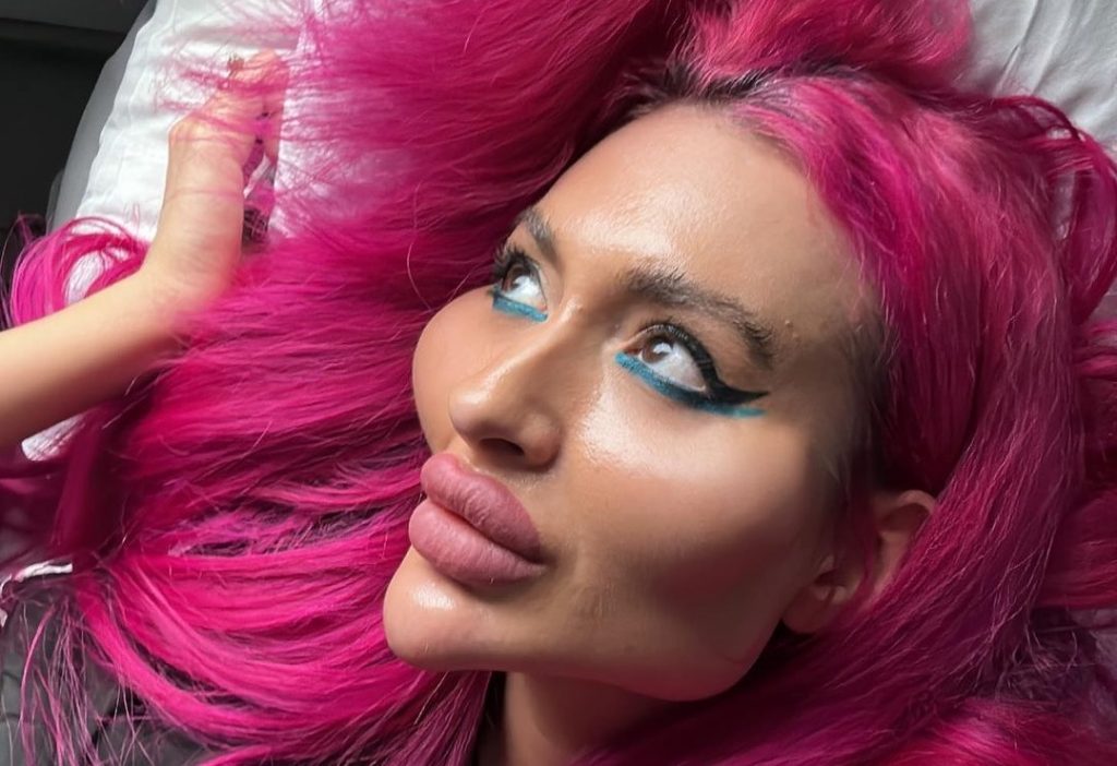 Influencer με τα «μεγαλύτερα μάγουλα του κόσμου» αποκαλύπτει πώς έμοιαζε πριν