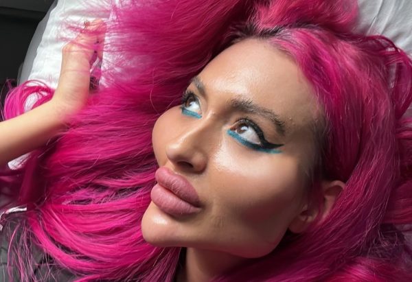 Influencer με τα «μεγαλύτερα μάγουλα του κόσμου» αποκαλύπτει πώς έμοιαζε πριν