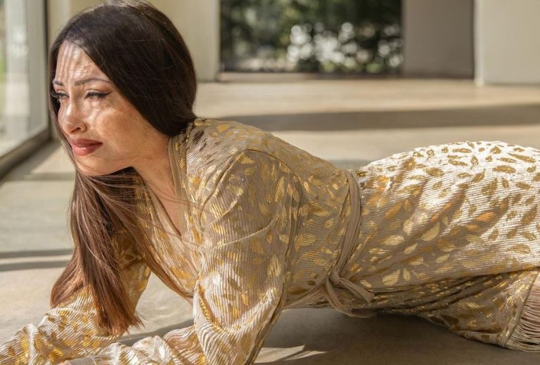 Ιωάννα Παλιοσπύρου: Πέρασαν 4 χρόνια από την ημέρα που άλλαξε η ζωή της – «Αγαπητέ εαυτέ, σε στηρίζω»