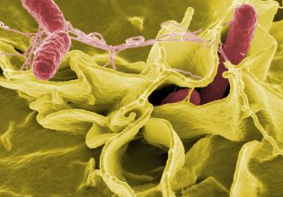 Φυματίωση και άλλα 5 ανθεκτικά μικρόβια μπαίνουν στην κρίσιμη λίστα του ΠΟΥ