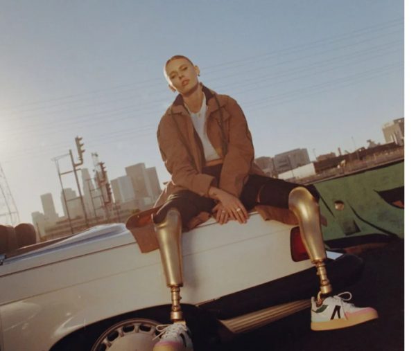 Μοντέλο έχασε και τα δύο πόδια της από το Σύνδρομο Τοξικού Σοκ – Το μήνυμα της