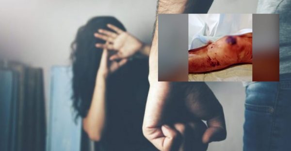 Ομόνοια: Γιατί αφέθηκε ελεύθερος ο 27χρονος που κατηγορείται για την άγρια κακοποίηση της 33χρονης