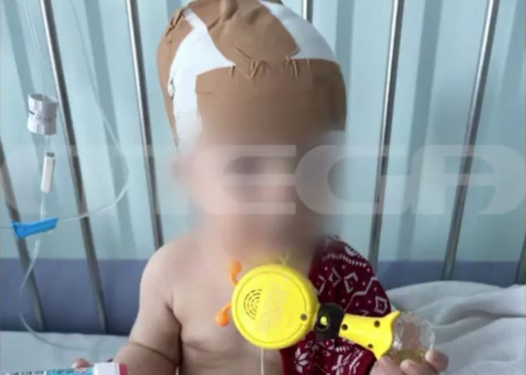 Νέα Σμύρνη: Εκτός κινδύνου το βρέφος που δάγκωσε ο σκύλος