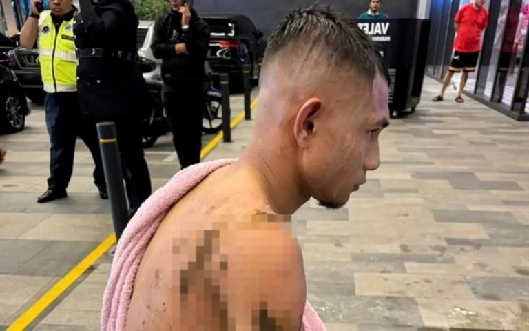 Στην εντατική διεθνής ποδοσφαιριστής μετά από επίθεση με καυστικό οξύ