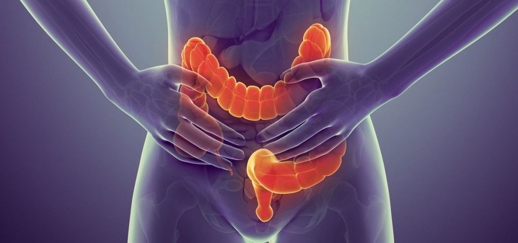 Δραματική αύξηση καρκίνων του παχέος εντέρου σε παιδιά, έφηβους και νέους