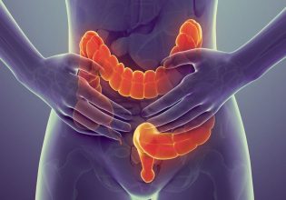 Δραματική αύξηση καρκίνων του παχέος εντέρου σε παιδιά, έφηβους και νέους