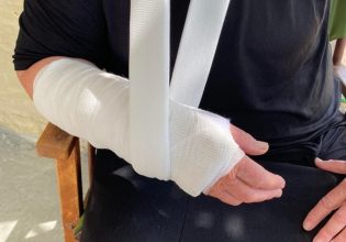 Αγρίνιο: Στο νοσοκομείο με σπασμένο χέρι 70χρονη έπειτα από απόπειρα ληστείας με δράστες δύο ανηλίκους