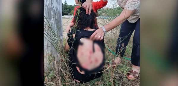 Θεσσαλονίκη: Άγρια επίθεση αγέλης σκύλων σε γυναίκα έξω από την επιχείρησή της