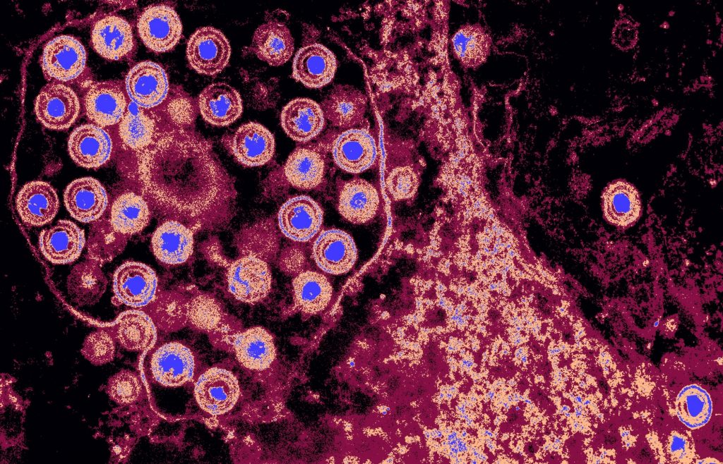 Οστά Νεάντερταλ έκρυβαν τους αρχαιότερους γνωστούς ιούς του ανθρώπου