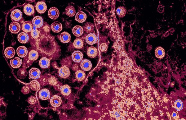 Οστά Νεάντερταλ έκρυβαν τους αρχαιότερους γνωστούς ιούς του ανθρώπου