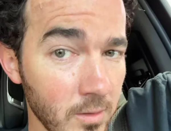 Ο Κέβιν Τζόνας αποκάλυψε ότι διαγνώστηκε με καρκίνο του δέρματος