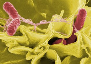 Μαγνησία: Τι είναι και πώς μεταδίδεται το βακτήριο της σαλμονέλας