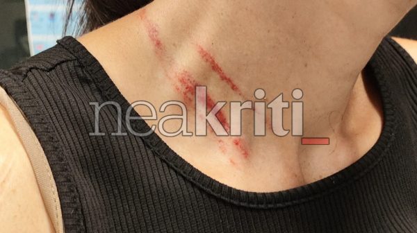 Απίστευτο σκηνικό βίας: Γυναίκα έβγαλε βόλτα το σκύλο της και… την έδειραν