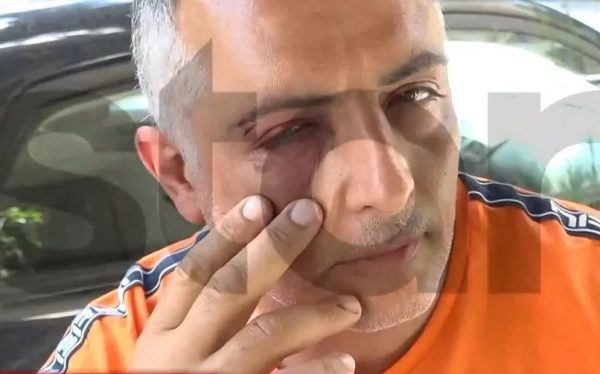 Τρεις επιβάτες ξυλοκόπησαν ελεγκτή εισιτηρίων σε λεωφορείο – «Με δάγκωσαν, με χτυπούσαν στο κεφάλι»