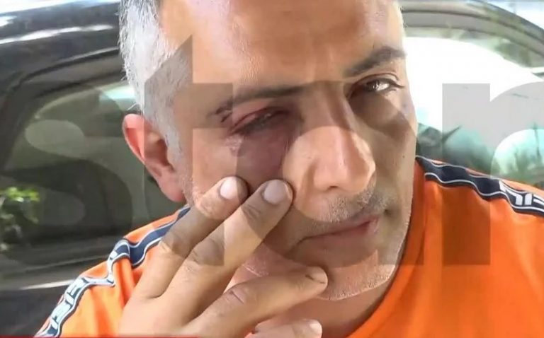 Τρεις επιβάτες ξυλοκόπησαν ελεγκτή εισιτηρίων σε λεωφορείο – «Με δάγκωσαν, με χτυπούσαν στο κεφάλι»