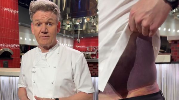 Γκόρντον Ράμσεϊ: Τρομακτικό ατύχημα με το ποδήλατο – Οι τεράστιες μελανιές και το μήνυμα που έστειλε