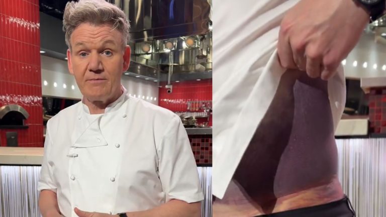 Γκόρντον Ράμσεϊ: Τρομακτικό ατύχημα με το ποδήλατο – Οι τεράστιες μελανιές και το μήνυμα που έστειλε