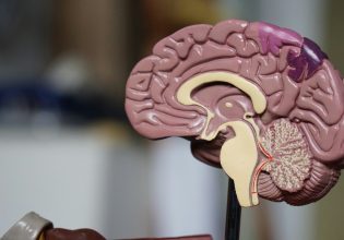 Οι Ηνωμένες Πολιτείες εγκρίνουν ένα νέο φάρμακο κατά του Αλτσχάιμερ