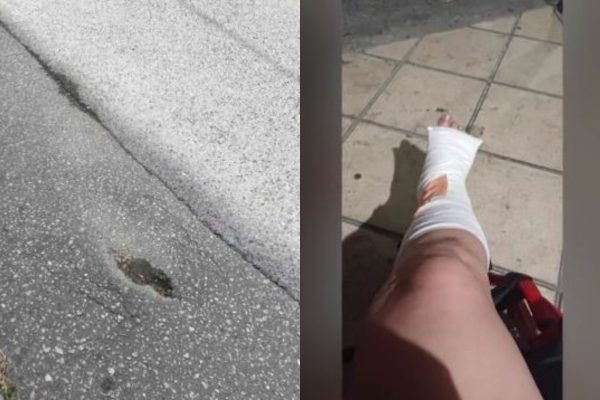 Θεσσαλονίκη: Σοβαρός τραυματισμός γυναίκας λόγω υποχώρησης οδοστρώματος – «Έχω πολλαπλά κατάγματα»