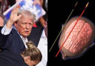 Ντόναλντ Τραμπ: Πού θα κατέληγε η σφαίρα εάν δεν έστριβε το κεφάλι του τη στιγμή της απόπειρας δολοφονίας;