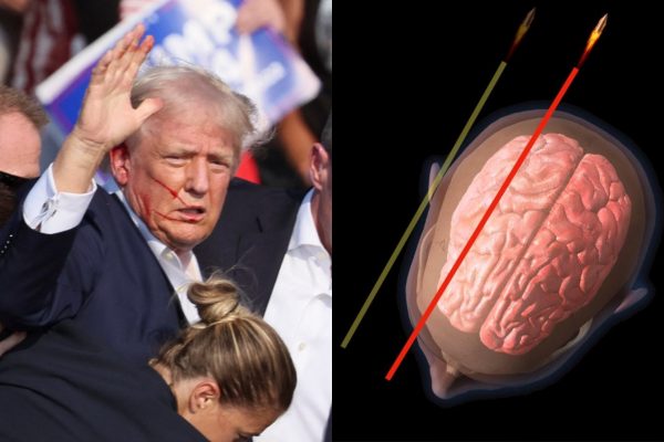 Ντόναλντ Τραμπ: Πού θα κατέληγε η σφαίρα εάν δεν έστριβε το κεφάλι του τη στιγμή της απόπειρας δολοφονίας;