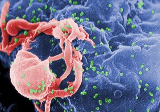 HIV: Έβδομη περίπτωση ασθενή που δείχνει να θεραπεύτηκε πλήρως