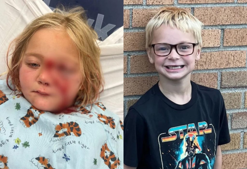 ΗΠΑ: Πώς ένας οκτάχρονος έσωσε την αδερφή του από σκύλο που χίμηξε να την σκοτώσει