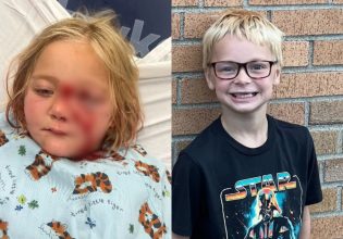 ΗΠΑ: Πώς ένας οκτάχρονος έσωσε την αδερφή του από σκύλο που χίμηξε να την σκοτώσει