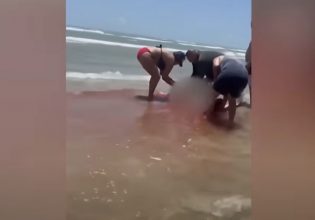 Τέξας: Επίθεση καρχαρία σε γυναίκα – Η θάλασσα έγινε κόκκινη από το αίμα