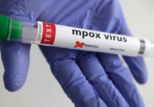 Mpox: Ο ιός μπορεί να είναι ήδη στην Ελλάδα – Τι λέει στο in ο καθηγητής του ΕΚΠΑ Νικόλαος Σπανάκης
