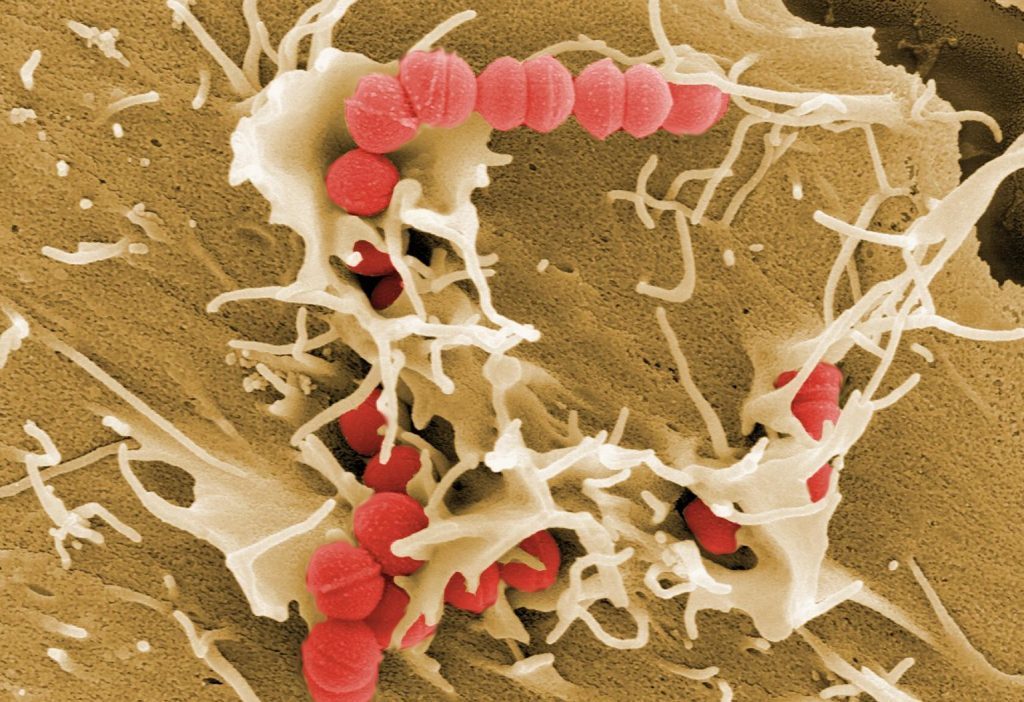 Στρεπτόκοκκος, το βακτήριο που ζει πάνω μας αλλά μπορεί να σκοτώσει