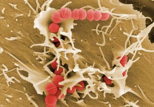 Στρεπτόκοκκος, το βακτήριο που ζει πάνω μας αλλά μπορεί να σκοτώσει